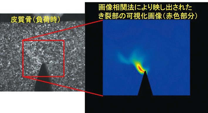 生体と医療で用いる材料の強度について研究しています