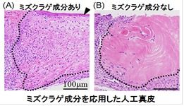 ミズクラゲより見出された新規表皮再生促進成分の同定