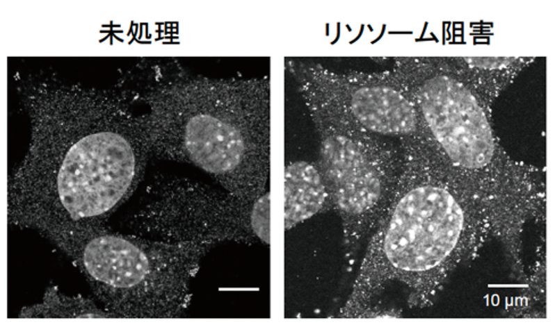 選択的オートファジーによる細胞内 品質管理の仕組みを明らかにする