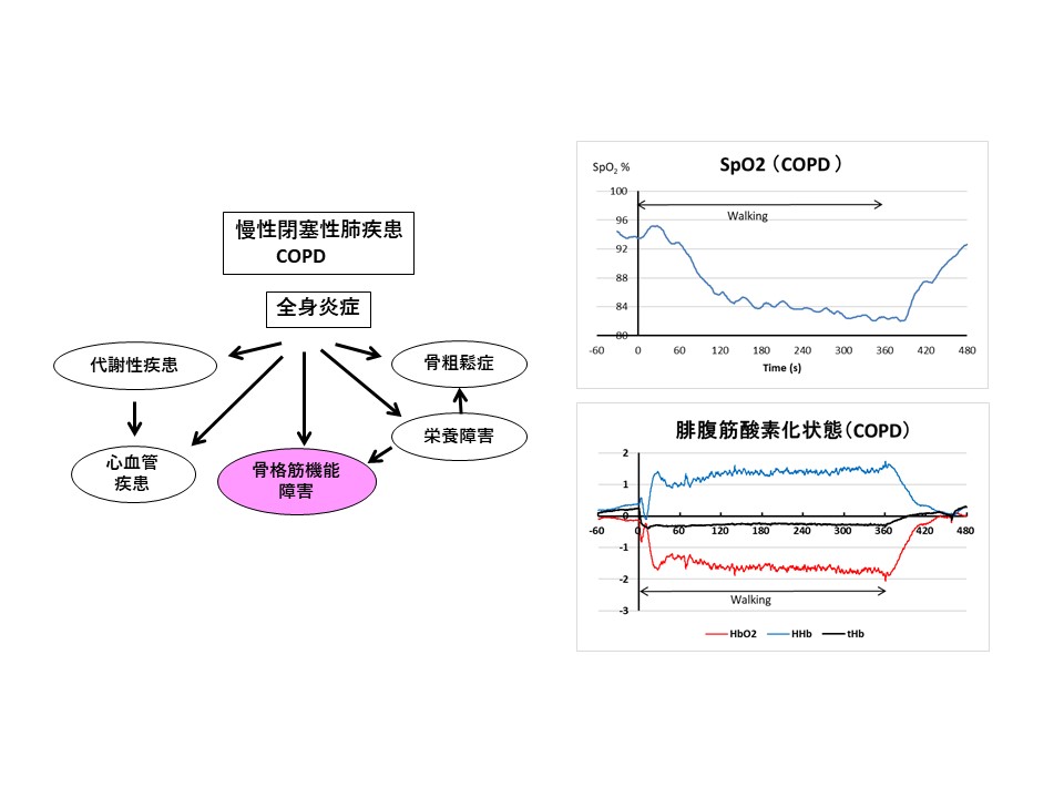 COPD患者やICU入室患者における運動中の筋肉酸素化状態