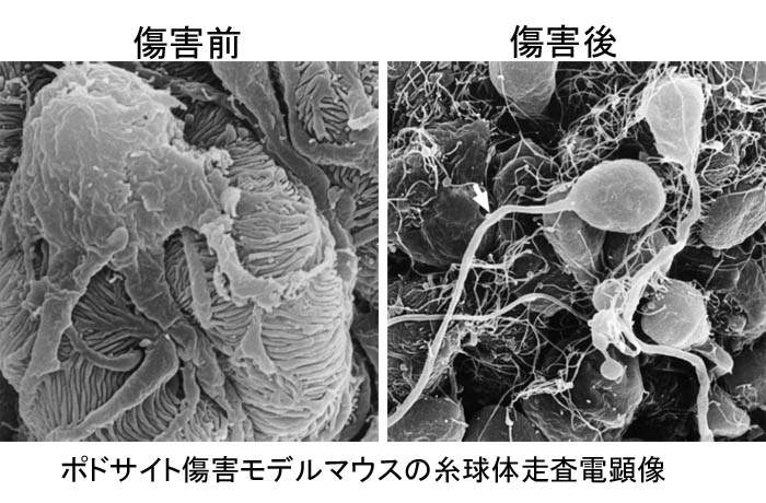 腎臓病の研究